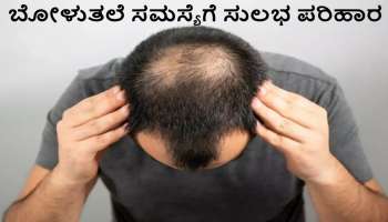 ಕೂದಲು ಅತಿಯಾಗಿ ಉದುರಲು ದೇಹದಲ್ಲಿ ಈ ವಿಟಮಿನ್‌ ಕೊರತೆಯೇ ಕಾರಣ..! ಈ ಸಮಸ್ಯೆಗೆ ಶಾಶ್ವತ ಪರಿಹಾರ ಪಡೆಯಲು ಇಲ್ಲಿದೆ ಸುಲಭ ಟಿಪ್ಸ್