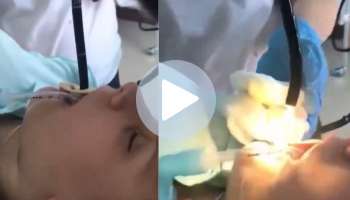 Viral Video: ಮಹಿಳೆಯ ಹೊಟ್ಟೆಯಿಂದ 4 ಅಡಿ ಉದ್ದದ ಜೀವಂತ ಹಾವನ್ನು ಹೊರ ತೆಗೆದ ವೈದ್ಯರು..! ವಿಷ ಸರ್ಪ ಮಹಿಳೆಯ ಹೊಟ್ಟೆ ಸೇರಿದ್ದು ಹೇಗೆ..? ನಿಮ್ಮ ನಿದ್ದೆ ಕೆಡಿಸುತ್ತೆ ವೈರಲ್‌ ವಿಡಿಯೋ 