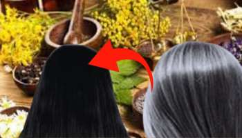 ದುಬಾರಿ ಪ್ರಾಡಕ್ಟ್ ಬೇಡ! ಮನೆಯಲ್ಲಿರುವ ಈ 2 ವಸ್ತುಗಳನ್ನು ಬೆರೆಸಿ ಬಿಳಿ ಕೂದಲನ್ನು ಬೇರುಗಳಿಂದಲೇ ಕಪ್ಪಾಗಿಸಿ...! 