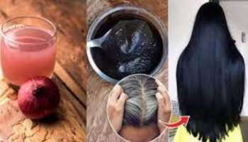 ಈರುಳ್ಳಿ ರಸದ ಹೇರ್ ಪ್ಯಾಕ್ ಹಾಕಿ ಬಿಳಿ ಕೂದಲನ್ನು ನೈಸರ್ಗಿಕವಾಗಿ ಕಪ್ಪು ಬಣ್ಣಕ್ಕೆ ತಿರುಗಿಸಿ..! 