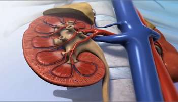 Kidney Stone: ಮೂತ್ರದಲ್ಲಿ ʻಈʼ ಲಕ್ಷಣಗಳು ಕಾಣಿಸಿಕೊಂಡರೆ, ನಿಮ್ಮ ಮೂತ್ರಪಿಂಡದಲ್ಲಿ ಕಲ್ಲುಗಳಿದೆ ಎಂದರ್ಥ! ಕೂಡಲೇ ಎಚ್ಚೆತ್ತುಕೊಳ್ಳಿ