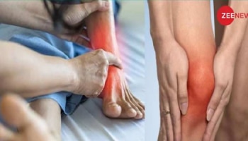 ದೇಹದಲ್ಲಿ ಸಂಗ್ರಹವಾಗಿರುವ ಯೂರಿಕ್ ಆಮ್ಲವನ್ನ ತಗ್ಗಿಸಲು ಔಷಧೀಯ ಗುಣಗಳಿರುವ ʼಈʼ ರಸವನ್ನ ಪ್ರತಿದಿನ ಕುಡಿಯಿರಿ