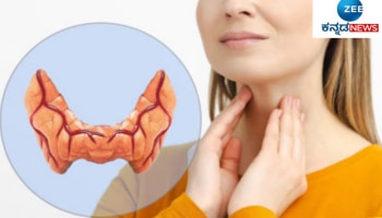 ಥೈರಾಯ್ಡ್‌ ನಿಯಂತ್ರಣಕ್ಕೆ ರಾಮಬಾಣ ಈ ಮೂರು ಹಣ್ಣುಗಳು..!