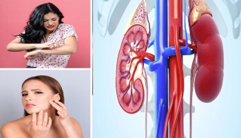 ಕಿಡ್ನಿಯಲ್ಲಿ ಸಮಸ್ಯೆ ಇದ್ದಾಗ ʼಈʼ ಲಕ್ಷಣಗಳು ಕಂಡುಬರುತ್ತವೆ; ಅಪ್ಪಿತಪ್ಪಿಯೂ ನಿರ್ಲಕ್ಷಿಸಬೇಡಿ!!