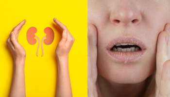 ಬೆಳಗ್ಗೆ ಏಳುತ್ತಿದ್ದಂತೆ ದೇಹದಲ್ಲಿ ಈ ಲಕ್ಷಣಗಳು ಕಾಣಿಸಿಕೊಂಡರೆ ನಿಮ್ಮ ಕಿಡ್ನಿ ಹಾಳಾಗಿದೆ ಎಂದರ್ಥ! 