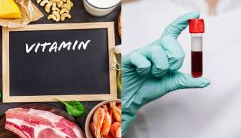 ಈ ವಿಟಮಿನ್ ಕೊರತೆಯಾದರೆ ದೇಹದಲ್ಲಿ ಕಡಿಮೆಯಾಗುತ್ತಾ ಹೋಗುವುದು ರಕ್ತ !ಬಚಾವಾಗಲು ಇದೊಂದೇ ದಾರಿ  