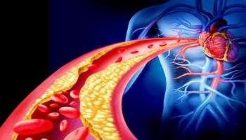 Heart Attack Warning Signs: ಎದೆಯಲ್ಲಿ ಅಲ್ಲ, ದೇಹದ ʻಈʼ ಭಾಗದಲ್ಲಿ ಪದೇ ಪದೇ ನೋವು ಕಾಣಿಸಿಕೊಳ್ಳುತ್ತಿದ್ದರೆ ಅದು  ಹೃದಯಾಘಾತದ ಮುನ್ಸೂಚನೆ! ನಿರ್ಲಾಕ್ಷ್ಯ ಮಾಡಿದರೆ ಅಪಾಯ ತಪ್ಪಿದ್ದಲ್ಲ