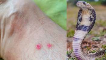 ಹಾವು ಕಚ್ಚಿದ ತಕ್ಷಣ ಇದನ್ನು ಈರುಳ್ಳಿಗೆ ಬೆರೆಸಿ ತಿನ್ನಿಸಿ ಸಾಕು.. ದೇಹ ಸೇರಲ್ಲ ವಿಷ! ಜೀವ ಉಳಿಸುವ ಏಕೈಕ ಪರಮಮಾರ್ಗವಿದು 