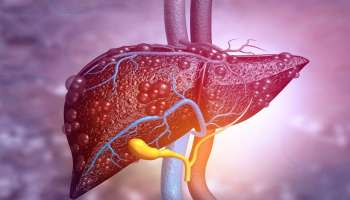 Fatty Liver: ಪ್ರತಿನಿತ್ಯ ಚಿಟಿಕೆಯಷ್ಟು ʻಈʼ ಪುಡಿಯನ್ನು ಬಾಯಿಗೆ ಹಾಕಿಕೊಂಡರೆ, ಯಾವುದೇ ಔಷಧಿ ಇಲ್ಲದೆ ಕಾಣೆಯಾಗುತ್ತೆ ಕೊಬ್ಬಿದ ಯಕೃತ್ತಿನ ಸಮಸ್ಯೆ!