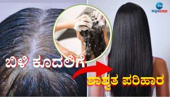 ಹೇರ್ ಡೈ, ಹೆನ್ನಾ ಅಲ್ಲವೇ ಅಲ್ಲ! ಈ ನ್ಯಾಚುರಲ್ ಶಾಂಪೂವಿನಿಂದ ಬಿಳಿ ಕೂದಲು ಮೂರೇ ನಿಮಿಷದಲ್ಲಿ ಶಾಶ್ವತವಾಗಿ ಕಪ್ಪಾಗುತ್ತೆ..! 