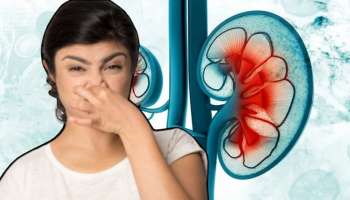 ದೇಹದ ಈ ಭಾಗದಿಂದ ಬರುವ ದುರ್ವಾಸನೆ ಕಿಡ್ನಿ ಸಮಸ್ಯೆಯ ಪ್ರಮುಖ ಲಕ್ಷಣ !