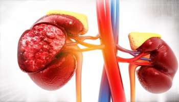 ಬೆಳಗ್ಗೆ ಎದ್ದ ಕೂಡಲೇ ದೇಹದ ಈ ಮೂರು ಭಾಗಗಳಲ್ಲಿ ಹಿಂಗೆಲ್ಲಾ ಆಗುತ್ತಿದ್ದರೆ ನಿಮ್ಮ ಕಿಡ್ನಿ ಹಾಳಾಗಿದೆ ಎಂದರ್ಥ!