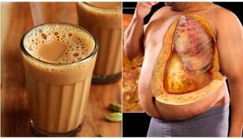 Fatty liver : ಚಹಾ ಕುಡಿದರೂ ಡ್ಯಾಮೇಜ್‌ ಆಗುತ್ತೆ ಲಿವರ್‌..! ನಿಮ್ಮ ಕಿಡ್ನಿ ಹಾಳಾಗುವ ಮುನ್ನ ಈ ವಿಚಾರ ತಿಳಿಯಿರಿ