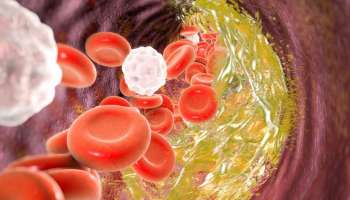 ವರ್ಷಗಳಿಂದ ದೇಹದಲ್ಲಿ ಶೇಕರಣೆಯಾದ ಕೊಬ್ಬನ್ನು ಕರಗಿಸಬಲ್ಲ ಶಕ್ತಿ ಇರುವ ಎಲೆಗಳಿವು.. ಹಸಿಯಾಗಿ ಇವುಗಳನ್ನು ಜಗಿದು ತಿಂದರೆ ಮಂಜುಗಡ್ಡೆಯಂತೆ ಕರಗುತ್ತೆ ಹೊಟ್ಟೆಯ ಬೊಜ್ಜು!