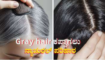 ಹೇರ್ ಡೈ ಬೇಡ... ಹಿತ್ತಲಲ್ಲಿ ಸಿಗುವ ಈ ಎಲೆಗಳಿಂದ ಬುಡದಿಂದಲೇ ಶಾಶ್ವತವಾಗಿ ಕಪ್ಪಾಗುತ್ತೆ ಬಿಳಿ ಕೂದಲು 