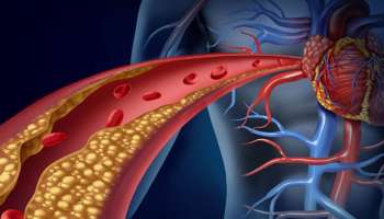 ಹಠಮಾರಿ ಕೆಟ್ಟ ಕೊಲೆಸ್ಟ್ರಾಲ್‌ನ್ನು ನಿಮಿಷದಲ್ಲಿ ಕರಗಿಸುತ್ತೆ ಈ ಎಲೆ! ಬೆಳಗಿನ ಜಾವ ಜಗಿದು ತಿನ್ನಿ ಸಾಕು.. 