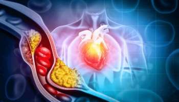 Heart Attack: ಹೃದಯಾಘಾತವಾಗುವ ಮುನ್ನ ನಿಮ್ಮ ದೇಹ ಕೊಡುವ ಸೂಚನೆಗಳಿವು! ಪದೇ ಪದೇ ʻಈʼ ಲಕ್ಷಣಗಳು ಕಾಣಿಸಿಕೊಂಡರೆ ನಿಮ್ಮ ಹಾರ್ಟ್‌ ಅಪಾಯದಲ್ಲಿದೆ ಎಂದರ್ಥ