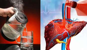 ದಿನದ ಈ ಹೊತ್ತಿನಲ್ಲಿ ಬಿಸಿ ನೀರು ಕುಡಿದ್ರೆ ಡ್ಯಾಮೇಜ್‌ ಆಗಿರುವ ಲಿವರ್‌ ಮೊದಲಿನಂತಾಗುವುದು! ವೈದ್ಯರೇ ಸೂಚಿಸಿದ ಮಾಂತ್ರಿಕ ಮಾರ್ಗವಿದು.. 