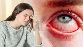 ಕಣ್ಣಿನಲ್ಲಿನ ಈ ಸಣ್ಣ ಬದಲಾವಣೆಯೇ ಬಿಪಿ-ಶುಗರ್‌ ಮೊದಲ ಲಕ್ಷಣ! ನಿರ್ಲಕ್ಷಿಸಿದ್ರೆ ಮಾರಕ ರೋಗಗಳಿಗೆ ಆಹ್ವಾನ ಕೊಟ್ಟಂತೆ..