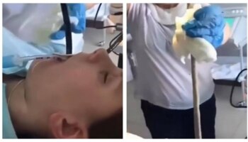  ಮಹಿಳೆಯ ಗಂಟಲಿನಿಂದ 4 ಅಡಿ ಉದ್ದದ ಹಾವನ್ನು ಹೊರತೆಗೆದ ವೈದ್ಯರು - ವಿಡಿಯೋ ವೈರಲ್