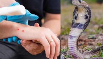 Snake Bite: ಎಷ್ಟೇ ವಿಷಕಾರಿ ಹಾವು ಕಚ್ಚಿದರೂ ಜೀವ ಉಳಿಸುತ್ತೆ ಈ ಚಿಕಿತ್ಸೆ! ಇದೊಂದು ಕೆಲಸ ಮಾಡಿದ್ರೆ ದೇಹ ಸೇರಲ್ಲ ವಿಷ..
