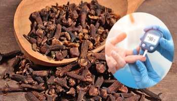 ಶುಗರ್‌ ಪೇಷಂಟ್‌ ಪ್ರತಿದಿನ ಲವಂಗ ತಿಂದರೆ ಏನಾಗುತ್ತದೆ ಗೊತ್ತಾ?