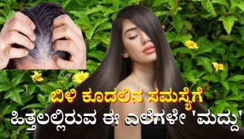 ಹಿತ್ತಲಲ್ಲೇ ಬೆಳೆಯಬಹುದಾದ ಈ ಎಲೆಯಿಂದ ಕೂಡಲೇ ಕಪ್ಪಾಗುತ್ತೆ ಬಿಳಿ ಕೂದಲು 