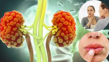 ದೇಹದ ಈ ಭಾಗದಲ್ಲಿ ಕಾಣಿಸುವ ಅಸಹಜ ತುರಿಕೆ ಕಿಡ್ನಿ ಸಮಸ್ಯೆಯ ಪ್ರಮುಖ ಲಕ್ಷಣ! ನಿರ್ಲಕ್ಷಿಸಿದ್ರೆ ಪ್ರಾಣಕ್ಕೇ ಬರುವುದು ಅಪಾಯ