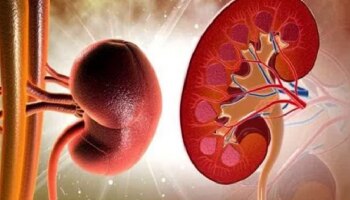 ಸಾಮಾನ್ಯ ಕಣ್ಣು ನೋವೆಂದು ಕಡೆಗಣಿಸಬೇಡಿ: ಇದು ಅಪಾಯಕಾರಿ ಕಿಡ್ನಿ ಖಾಯಿಲೆಯ ಲಕ್ಷಣವಾಗಿರಬಹುದು... 