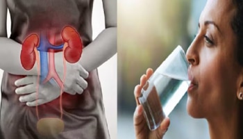 ಕಿಡ್ನಿ ವೈಫಲ್ಯವನ್ನ ತಡೆಗಟ್ಟಲು ಪ್ರತಿದಿನ ನೀವು ಇಷ್ಟು ಲೀಟರ್‌ ನೀರು ಕುಡಿಯಬೇಕು