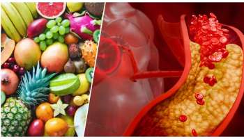 ಕೊಲೆಸ್ಟ್ರಾಲ್ ಹೆಚ್ಚಾದಾಗ ಈ 5 ಆಹಾರಗಳನ್ನು ತಿನ್ನಿ, ಹೃದಯಕ್ಕೆ ಯಾವ ಅಪಾಯವೂ ಆಗಲ್ಲ..!