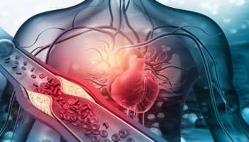 Heart attack: ಹೃದಯಾಘಾತವಾಗುವ ಮುನ್ನ ಚರ್ಮದಲ್ಲಿ ಈ ಲಕ್ಷಣಗಳು ಕಾಣಿಸಕೊಳ್ಳುತ್ತವೆ! ಈ ಮುನ್ಸೂಚನೆಗಳನ್ನು ಕಡೆಗಣಿಸಿದರಿ.. ಇಲ್ಲಾ ಅಂದ್ರೆ ಅಪಾಯ ಖಚಿತ