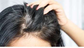 ವಯಸ್ಕರೇ ನೀವು ತಿಳಿಯದೇ ಮಾಡುವ ಈ ತಪ್ಪುಗಳಿಂದಲೇ ತಲೆಯಲ್ಲಿ ಬಿಳಿ ಕೂದಲು ಹೆಚ್ಚಾಗೋದು..! ತಕ್ಷಣ ಸಮಸ್ಯೆ ಕಡಿಮೆ ಮಾಡಲು ಇದೊಂದೆ ಮಾರ್ಗ