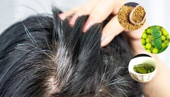 ನೈಸರ್ಗಿಕವಾಗಿ ಬಿಳಿ ಕೂದಲು ಸಮಸ್ಯೆ ನಿವಾರಿಸಲು ಈ ಸರಳ 10 ಮಾರ್ಗಗಳನ್ನು ಅನುಸರಿಸಿ...!