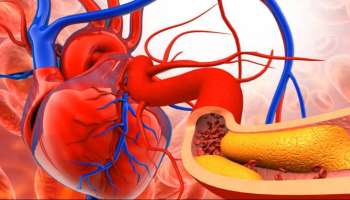 ಹೃದಯಘಾತವಾಗುವ ಒಂದು ವಾರದ ಮೊದಲು ದೇಹದಲ್ಲಿ ʻಈʼ ಲಕ್ಷಣಗಳು ಕಾಣಿಸುತ್ತವೆ! ಅನೇಕರು ಇದನ್ನ ನಿರ್ಲಕ್ಷಿಸುವುದೇ ಹೆಚ್ಚು