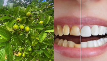 ಹಲ್ಲಿನ ಮೇಲಿನ ಕೊಳಕು ಹಳದಿ ಕಲೆಗೆ ರಾಮಬಾಣ ಈ ಹಣ್ಣಿನ ಗಿಡದ ಎಲೆ.. ಉಪ್ಪಿನೊಂದಿಗೆ ಬೆರೆಸಿ ಉಜ್ಜಿದರೆ ವಯಸ್ಸು 70 ದಾಟಿದ್ರೂ ಹಲ್ಲು ಹುಳುಕಾಗಲ್ಲ!