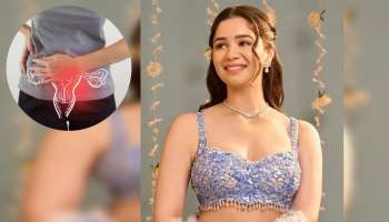 ಅಪರೂಪದ ಕಾಯಿಲೆಗೆ ತುತ್ತಾದ ಸಾರಾ..! ಸಚಿನ್‌ ಪುತ್ರಿಯನ್ನ ಬಿಡದೇ ಕಾಡುತ್ತಿರುವ ಆ ಗಂಭೀರ ಸಮಸ್ಯೆ ಏನು? ಆಘಾತಕಾರಿ ಸತ್ಯ ಬಹಿರಂಗಪಡಿಸಿದ ಸಾರಾ