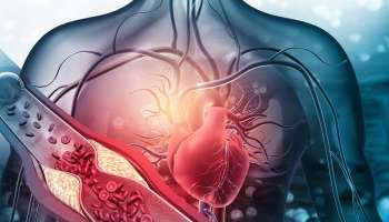 ಹೃದಯಾಘಾತಕ್ಕೂ ಕೆಲವು ದಿನಗಳ ಮುನ್ನ ಕಾಣಿಸಿಕೊಳ್ಳುವ ಲಕ್ಷಣಗಳಿವು! ದೇಹ ಈ ಸೂಚನೆ ಕೊಟ್ರೆ ಹಾರ್ಟ್‌ ಅಟ್ಯಾಕ್‌ ಆಗೋದು ಫಿಕ್ಸ್‌