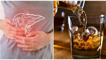 ನೀವು ಪ್ರತಿ ದಿನ ಎಣ್ಣೆ ಕುಡಿತೀರಾ.? ಹಾಗಿದ್ರೆ, ಒಮ್ಮೆ ಇಲ್ಲಿ ನೋಡಿ ಈಕೆಗೆ ಆದ ಗತಿ ನಿಮಗೂ ಆಗಬಹುದು.!