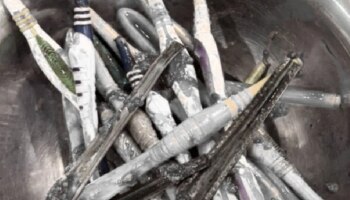 Viral News: ದ್ವೇಷ, ಕೋಪಕ್ಕೆ 29 ಚಮಚ, 19 ಟೂತ್ ಬ್ರಶ್, 2 ಪೆನ್ನು ನುಂಗಿದ ಭೂಪ..!