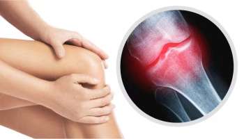 ಕೀಲು ನೋವು ಸಮಸ್ಯೆಯೇ? ಆಯುರ್ವೇದದಲ್ಲಿದೆ ತ್ವರಿತ ಪರಿಹಾರ