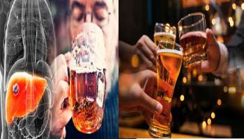 ನೀವು ಡ್ರಿಂಕ್ಸ್‌ ಮಾಡದಿದ್ರೂ ದೇಹದಲ್ಲಿ ಇರುತ್ತೆ ಮದ್ಯ..! ಕುಡಿಯದೇ ಇದ್ರೂ ಹೊಟ್ಟೆಯಲ್ಲಿ ಆಲ್ಕೋಹಾಲ್ ಉತ್ಪತ್ತಿಯಾಗುತ್ತೆ ಎಂಬ ಸತ್ಯ ನಿಮಗೆ ಗೊತ್ತಾ..?