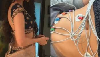 ಖ್ಯಾತ ಬಿಗ್‌ಬಾಸ್‌ ಸ್ಪರ್ಧಿಗೆ ಗಂಭೀರ ಆರೋಗ್ಯ ಸಮಸ್ಯೆ.. ಚಿಕಿತ್ಸೆಗಾಗಿ ಆಸ್ಪತ್ರೆಗೆ ದಾಖಲು!