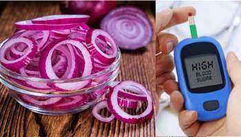 ಈರುಳ್ಳಿ ಇದರಲ್ಲಿ ನೆನೆಯಿಟ್ಟು ಬೆಳಗೆದ್ದು ತಿಂದರೆ ದಿನವಿಡಿ ಕಂಟ್ರೋಲ್‌ನಲ್ಲಿರುತ್ತೆ ಬ್ಲಡ್ ಶುಗರ್‌!