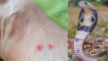 Snake Bite Remedies: ಹಾವು ಕಡಿತಕ್ಕೆ ಈ ಸರಳ ಪರಿಹಾರ ಅಳವಡಿಸಿಕೊಳ್ಳಿ ತಕ್ಷಣ ವಿಷ ಕಡಿಮೆಯಾಗುತ್ತದೆ..!