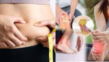 ಈ ಎರಡು ಮನೆಮದ್ದನ್ನು ಬಳಸಿದರೆ ಯೂರಿಕ್ ಆಸಿಡ್ ಕರಗುವುದಷ್ಟೇ ಅಲ್ಲ, ತೂಕವೂ ಇಳಿಕೆಯಾಗುತ್ತೆ!