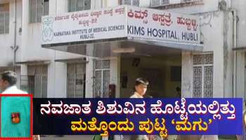 14ದಿನಗಳ ಹಸುಗೂಸಿನ ಹೊಟ್ಟೆಯಲ್ಲಿತ್ತು ಮತ್ತೊಂದು ಮಗು: ಶಸ್ತ್ರಚಿಕಿತ್ಸೆ ಮೂಲಕ &#039;ಭ್ರೂಣ&#039; ಹೊರತೆಗೆದ ಕಿಮ್ಸ್ ವೈದ್ಯರು 