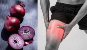 ಕೀಲುಗಳಲ್ಲಿನ ಯುರಿಕ್‌ ಆಸಿಡ್‌ ಕರಗಲು ಹಸಿ ಈರುಳ್ಳಿಗೆ ಇದನ್ನು ಬೆರೆಸಿ ತಿನ್ನಿ.. ಕಿಡ್ನಿ ಸ್ಟೋನ್‌ ಆಪರೇಷನ್‌ ಇಲ್ಲದೇ ಹೊರಬರುವುದು!  