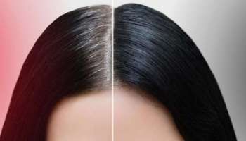 ಈ 3 ಆಯುರ್ವೇದ ಗಿಡಮೂಲಿಕೆ ಬಿಳಿ ಕೂದಲನ್ನು ಶಾಶ್ವತವಾಗಿ ಕಪ್ಪಾಗಿಸುತ್ತವೆ! ಯಾವುದೇ ಅಡ್ಡಪರಿಣಾಮ ಇಲ್ಲ 