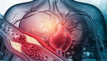 ಹೃದಯಾಘಾತವಾಗುವ 2 ದಿನಕ್ಕೂ ಮೊದಲೇ ಕಾಣಿಸಿಕೊಳ್ಳುವ ಲಕ್ಷಣಗಳಿವು! ಅಪ್ಪಿತಪ್ಪಿಯೂ ನಿರ್ಲಕ್ಷಿಸಬೇಡಿ.. 